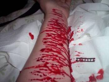 douleur